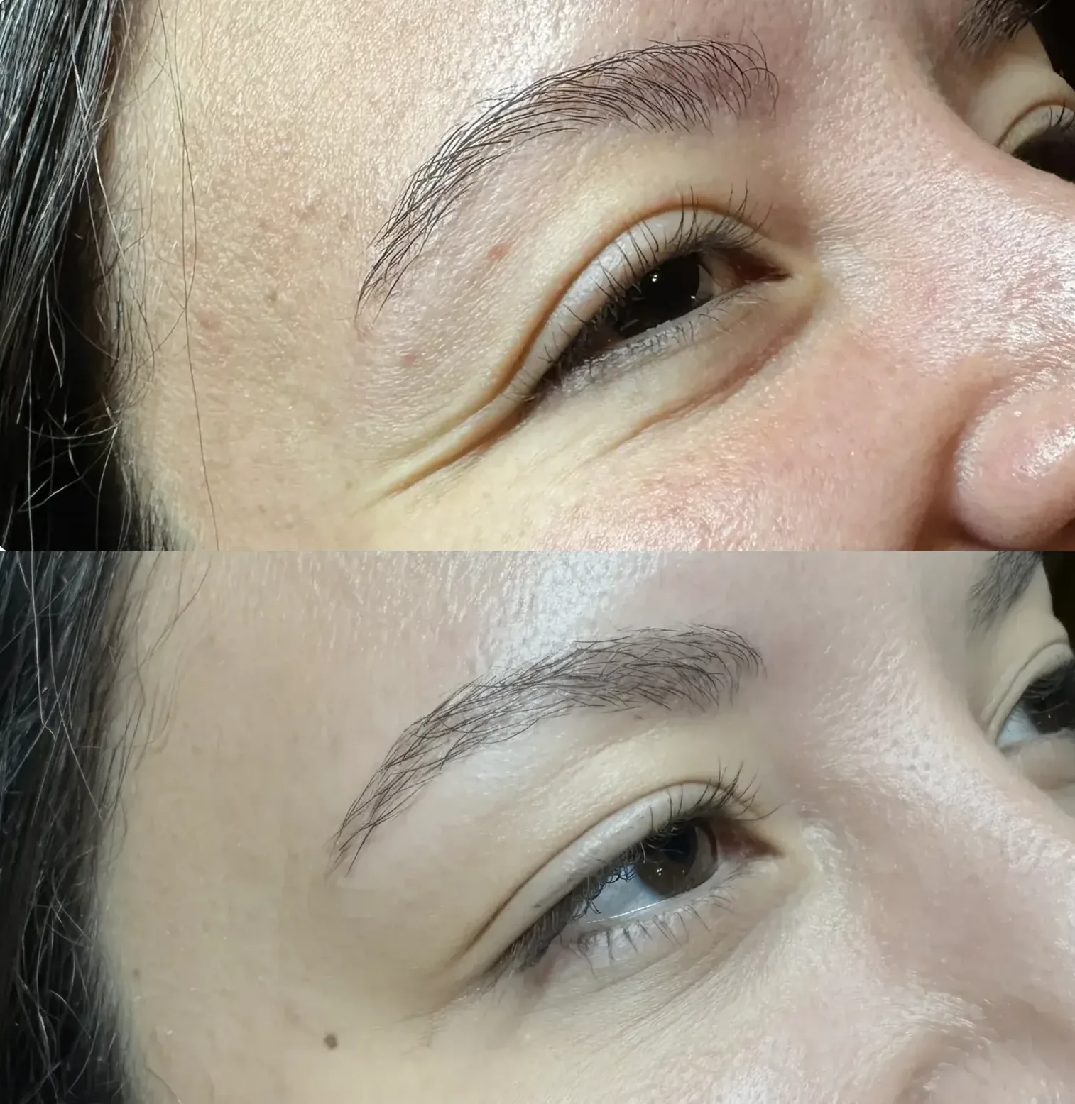 Before After Letybo Crow's Feet